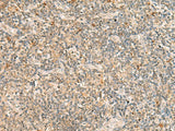 Immunohistochemistry of paraffin-embedded Human tonsil tissue using TBCK Polyclonal Antibody at dilution of 1:25(×200)