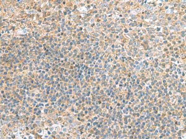 Anti-Human/Mouse TSTA3 Antibody