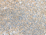 Immunohistochemistry of paraffin-embedded Human tonsil tissue using TSTA3 Polyclonal Antibody at dilution of 1:45(×200)