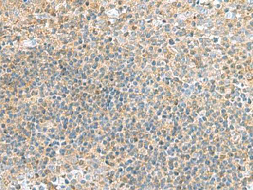 Anti-Human/Mouse TSTA3 Antibody