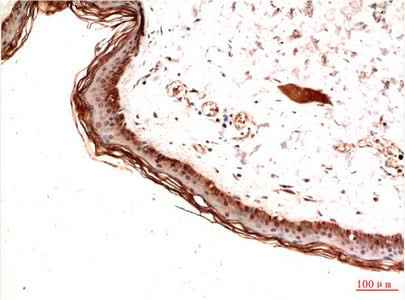 Anti-Human/Mouse/Rat PDGFRA Antibody [4E7]