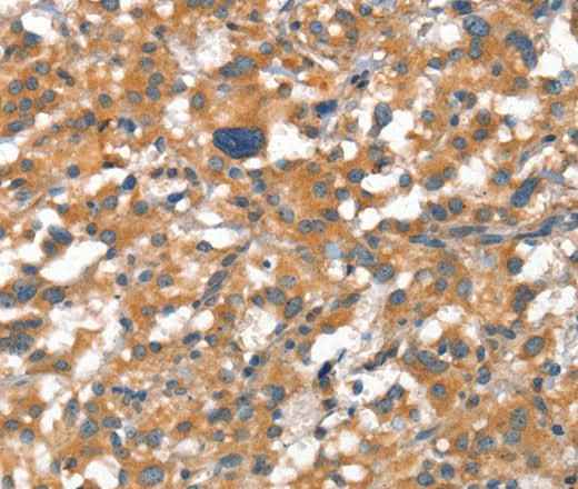 Anti-Human CDH5 Antibody