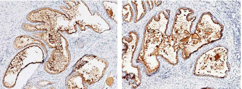 Anti-Human KLK3 Antibody [A1163] - ABMIUM