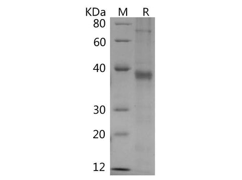 SDS-PAGE analysis of Human AGER proteins, 2 μg/lane of Recombinant Human AGER proteins was resolved with SDS-PAGE under reducing conditions, showing bands at 38 kDa.