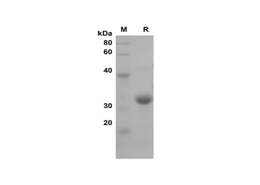 SDS-PAGE analysis of Mouse IL-1b proteins, 2 μg/lane of Recombinant Mouse IL-1b proteins was resolved with SDS-PAGE under reducing conditions, showing bands at 34 kDa.