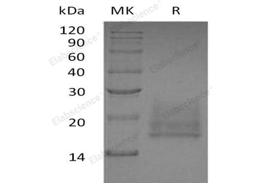 Recombinant Human CEACAM8/CD66b Protein (His Tag) - ABMIUM
