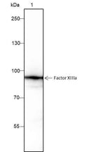 Anti-Human/Rat/Mouse Factor XIIIa Antibody [A218]