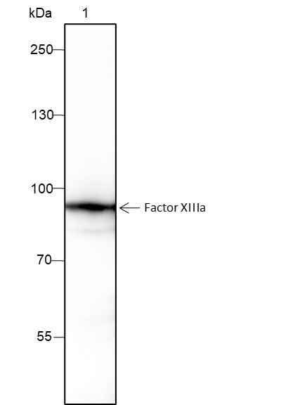 Anti-Human/Rat/Mouse Factor XIIIa Antibody [A218] - ABMIUM