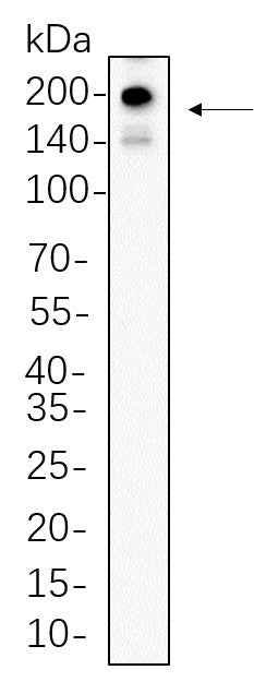 Anti-Human/Mouse/Rat PDGFR-α Antibody [B748] - ABMIUM