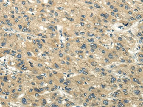 Anti-Human/Mouse/Rat CHGB Antibody - ABMIUM