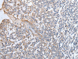 Immunohistochemistry of paraffin-embedded Human tonsil tissue using GPD2 Polyclonal Antibody at dilution of 1:40(×200)