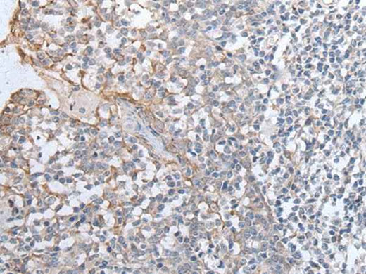 Anti-Human/Mouse/Rat GPD2 Antibody