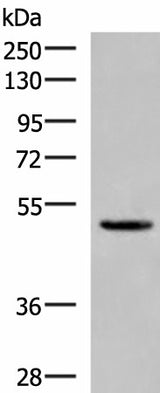 Western blot analysis of Human cerebrum tissue lysate using PSMD12 Polyclonal Antibody at dilution of 1:900
