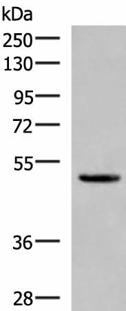 Western blot analysis of Human cerebrum tissue lysate using PSMD12 Polyclonal Antibody at dilution of 1:900