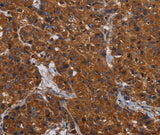 Anti-Human/Mouse/Rat HYAL2 Antibody - ABMIUM