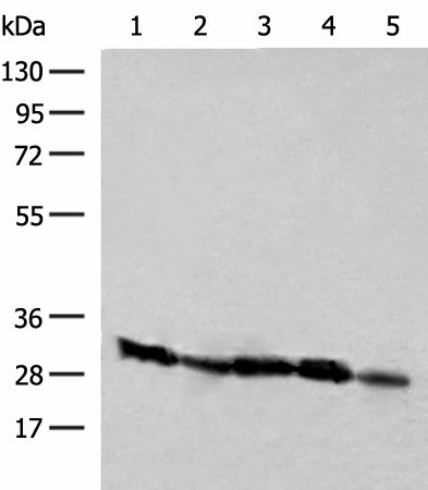 Western blot analysis of Raji Jurkat K562 and 231 cell Human kidney tissue lysates using CD48 Polyclonal Antibody at dilution of 1:250
