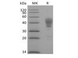 Recombinant Human Signal Transducer CD24/CD24 (C-Fc) - ABMIUM
