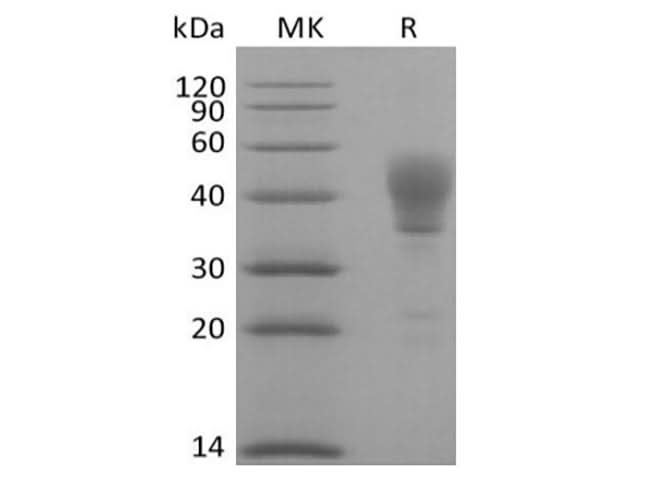 Recombinant Human Signal Transducer CD24/CD24 (C-Fc) - ABMIUM