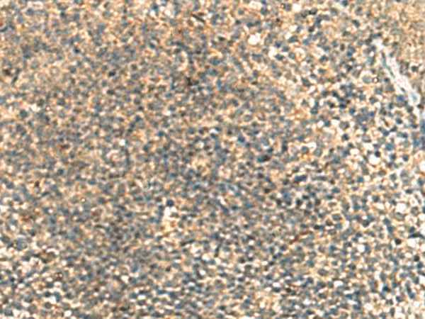 Anti-Human/Mouse TCAP Antibody