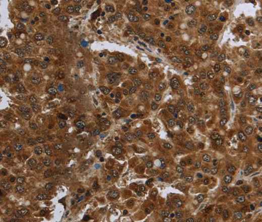 Anti-Human FASTKD1 Antibody