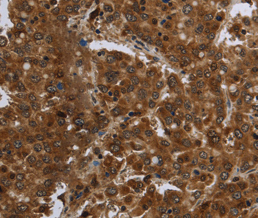 Anti-Human FASTKD1 Antibody - ABMIUM