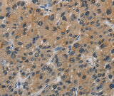 Anti-Human CASP9 Antibody - ABMIUM