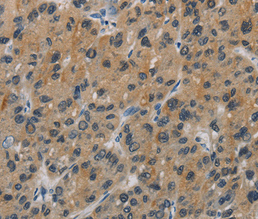 Anti-Human CASP9 Antibody - ABMIUM