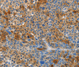 Anti-Human/Mouse/Rat HTRA3 Antibody - ABMIUM