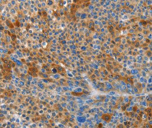 Anti-Human/Mouse/Rat HTRA3 Antibody