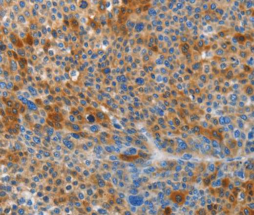 Anti-Human/Mouse/Rat HTRA3 Antibody - ABMIUM