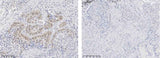 Anti-Human AKT1 Antibody [A1196] - ABMIUM