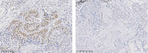 Anti-Human AKT1 Antibody [A1196] - ABMIUM
