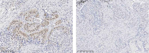 Anti-Human AKT1 Antibody [A1196] - ABMIUM