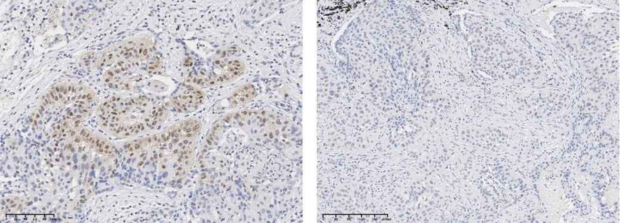 Anti-Human AKT1 Antibody [A1196] - ABMIUM