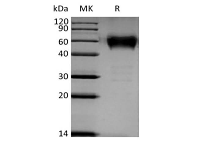 Recombinant Human B- and T-Lymphocyte Attenuator/BTLA/CD272 (C-mFc) - ABMIUM