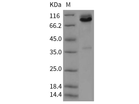 Recombinant Rat Syndecan-1/SDC1 Protein (Fc Tag) - ABMIUM