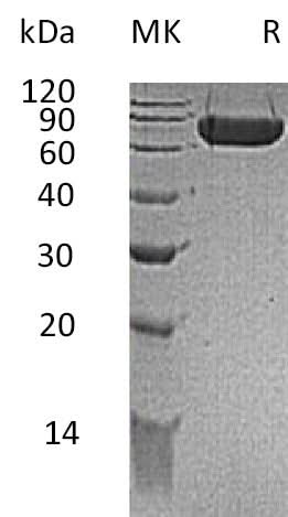 Recombinant Mouse KIRREL1/NEPH1 Protein (His Tag) - ABMIUM