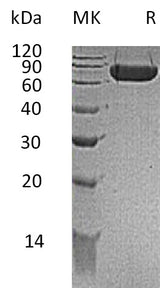 Recombinant Mouse KIRREL1/NEPH1 Protein (His Tag) - ABMIUM