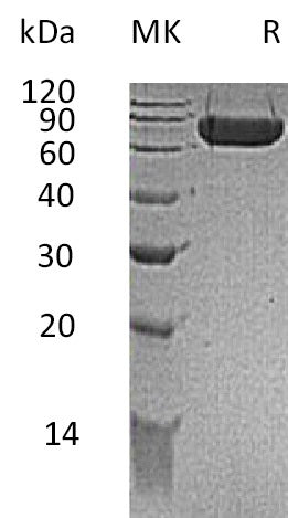 Recombinant Mouse KIRREL1/NEPH1 Protein (His Tag) - ABMIUM