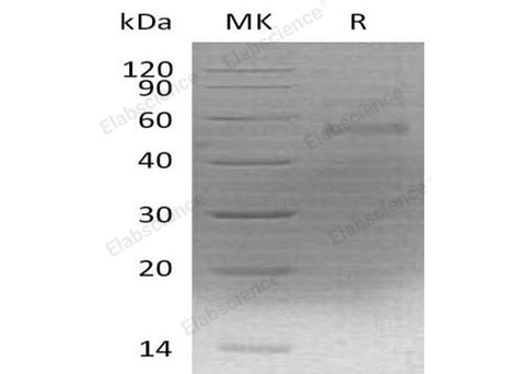 Recombinant Mouse Coagulation Factor X/F10 Protein (His Tag) - ABMIUM