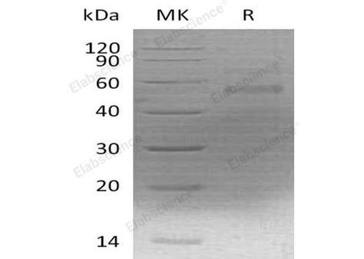 Recombinant Mouse Coagulation Factor X/F10 Protein (His Tag) - ABMIUM
