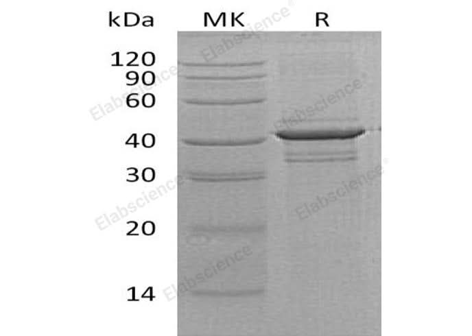 Recombinant Human Calreticulin-3/CALR3 Protein - ABMIUM