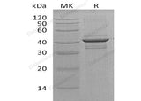 Recombinant Human Calreticulin-3/CALR3 Protein - ABMIUM