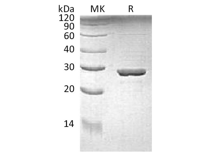 Recombinant E.coli Tryptophan Synthase α Chain/Trp A Protein - ABMIUM