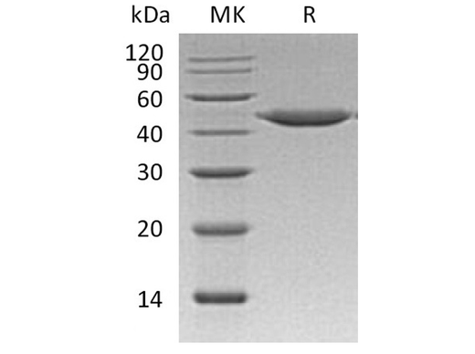Recombinant Human Cathepsin E/CTSE Protein (His Tag) - ABMIUM