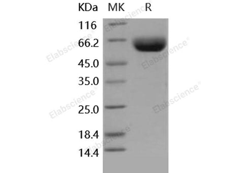 Recombinant Human CD147/Basigin Protein (Fc Tag) - ABMIUM