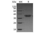 Recombinant Human FOLR1 Protein (His Tag) - ABMIUM