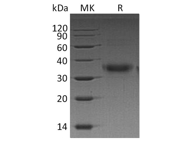 Recombinant Human FOLR1 Protein (His Tag) - ABMIUM