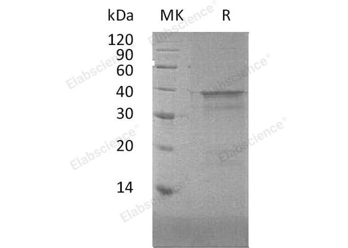 Recombinant Human NFYA Protein - ABMIUM