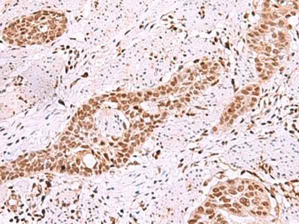 Anti-Human/Mouse/Rat ISL2 Antibody